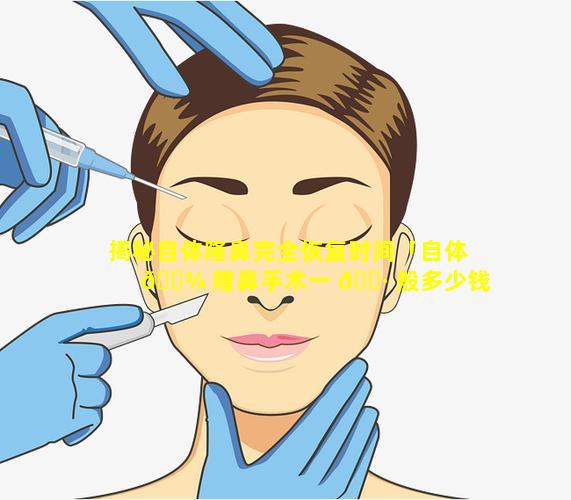 揭秘自体隆鼻完全恢复时间「自体 🌾 隆鼻手术一 🕷 般多少钱」